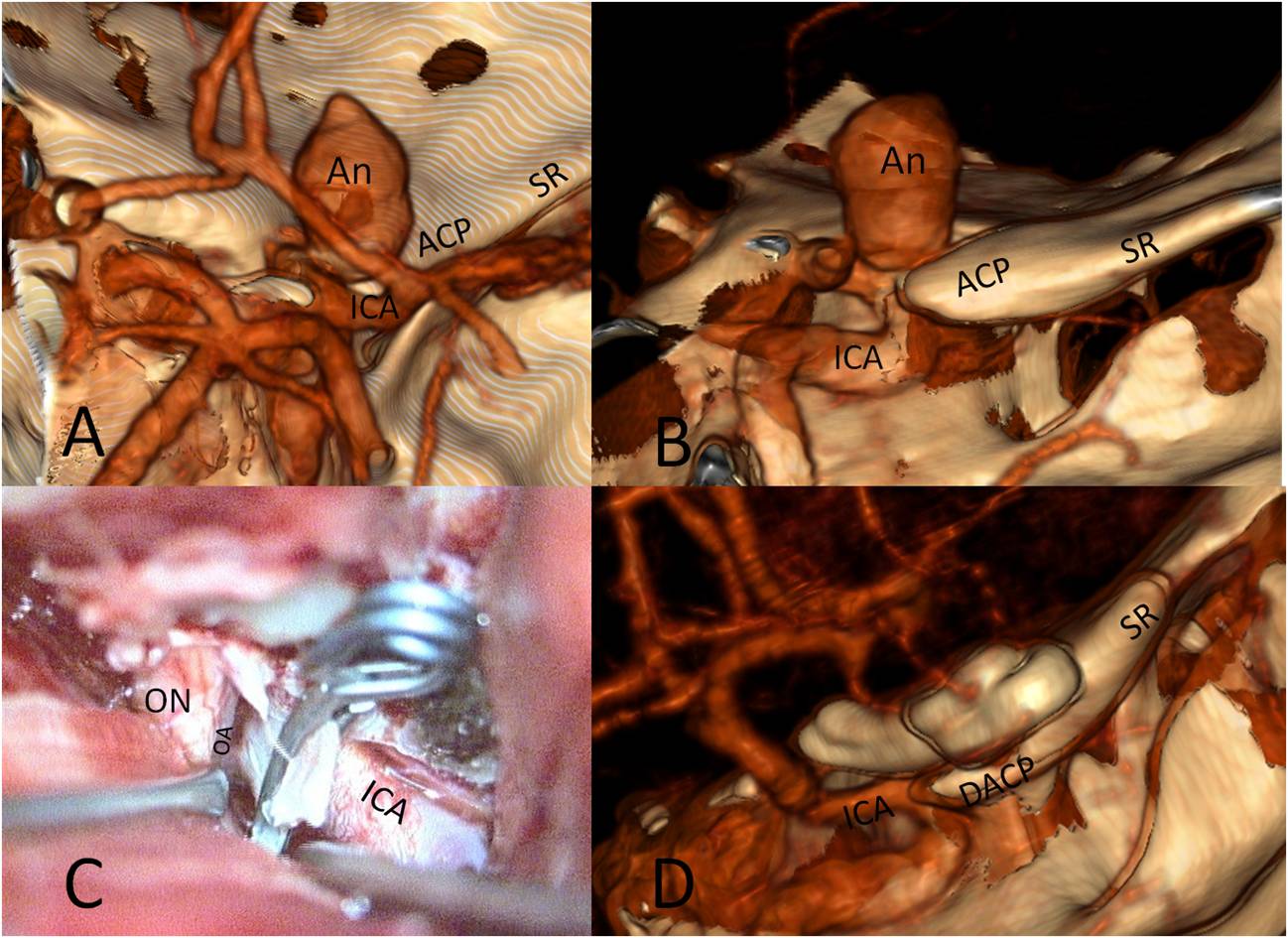 figure4